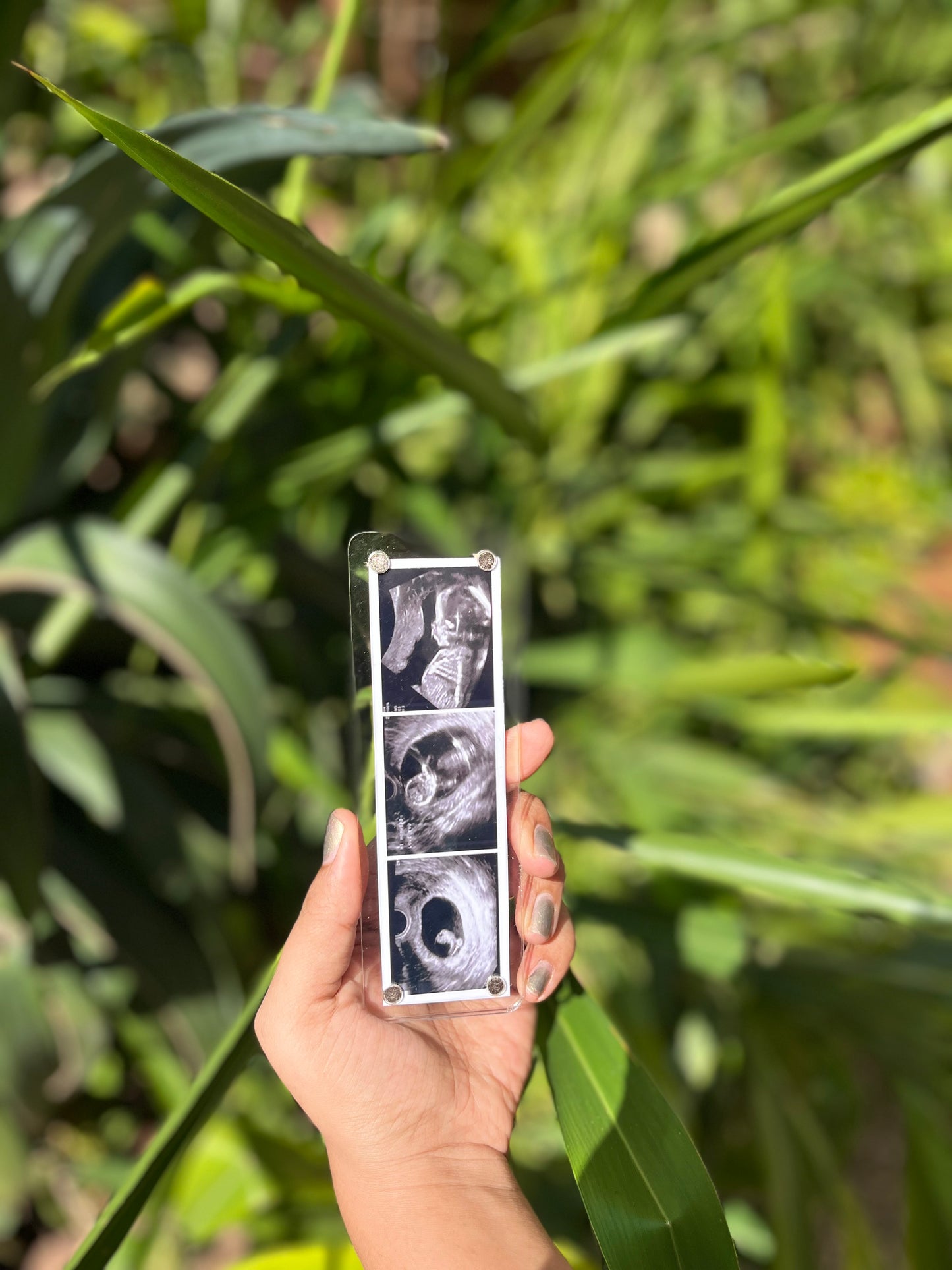 Sonogram fridge magnet