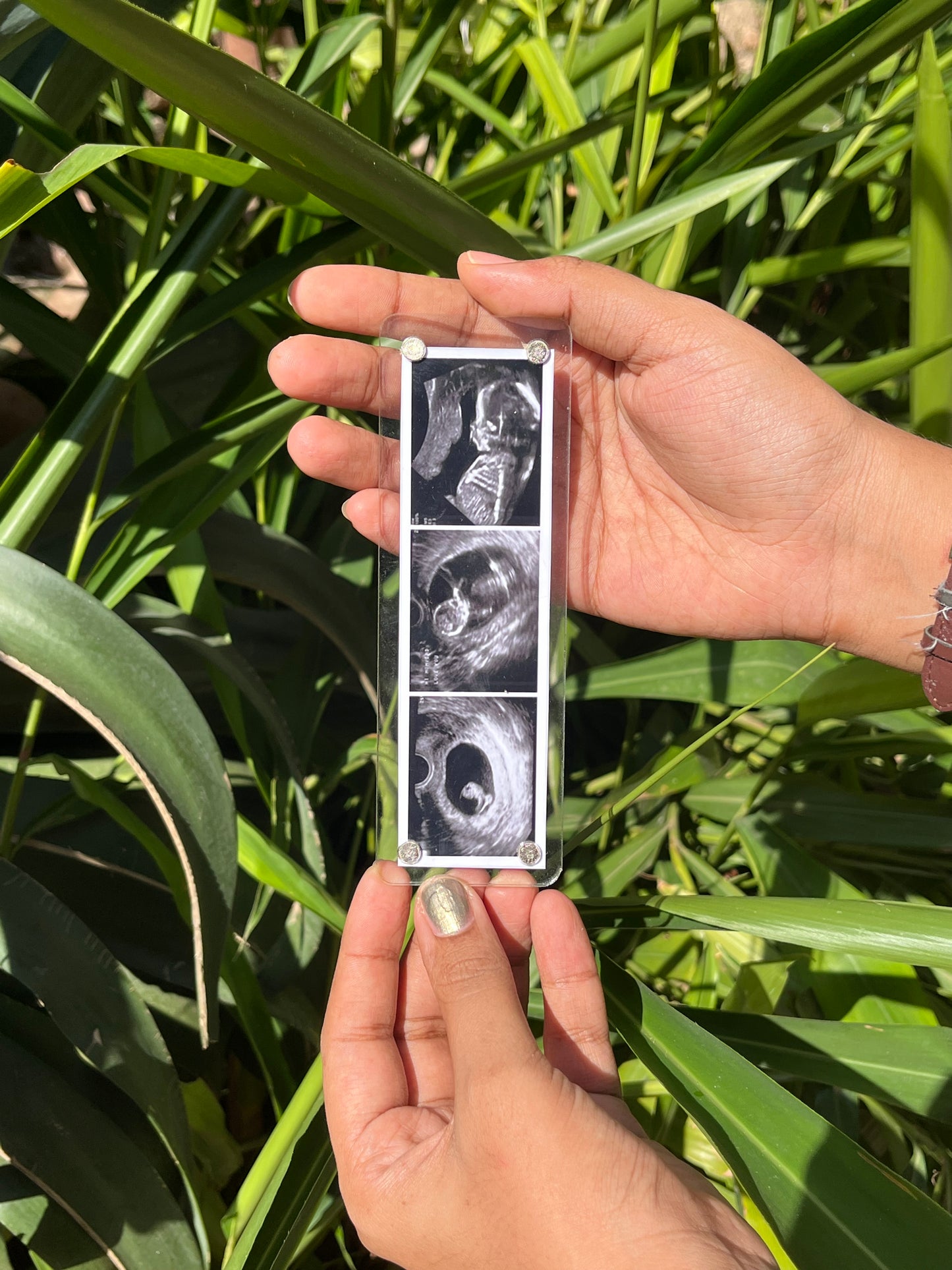 Sonogram fridge magnet
