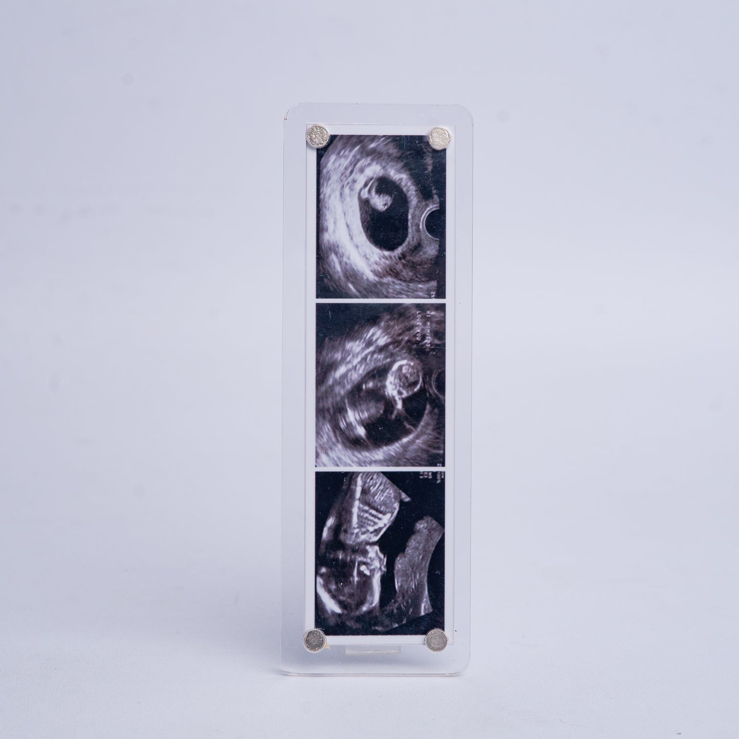 Sonogram fridge magnet