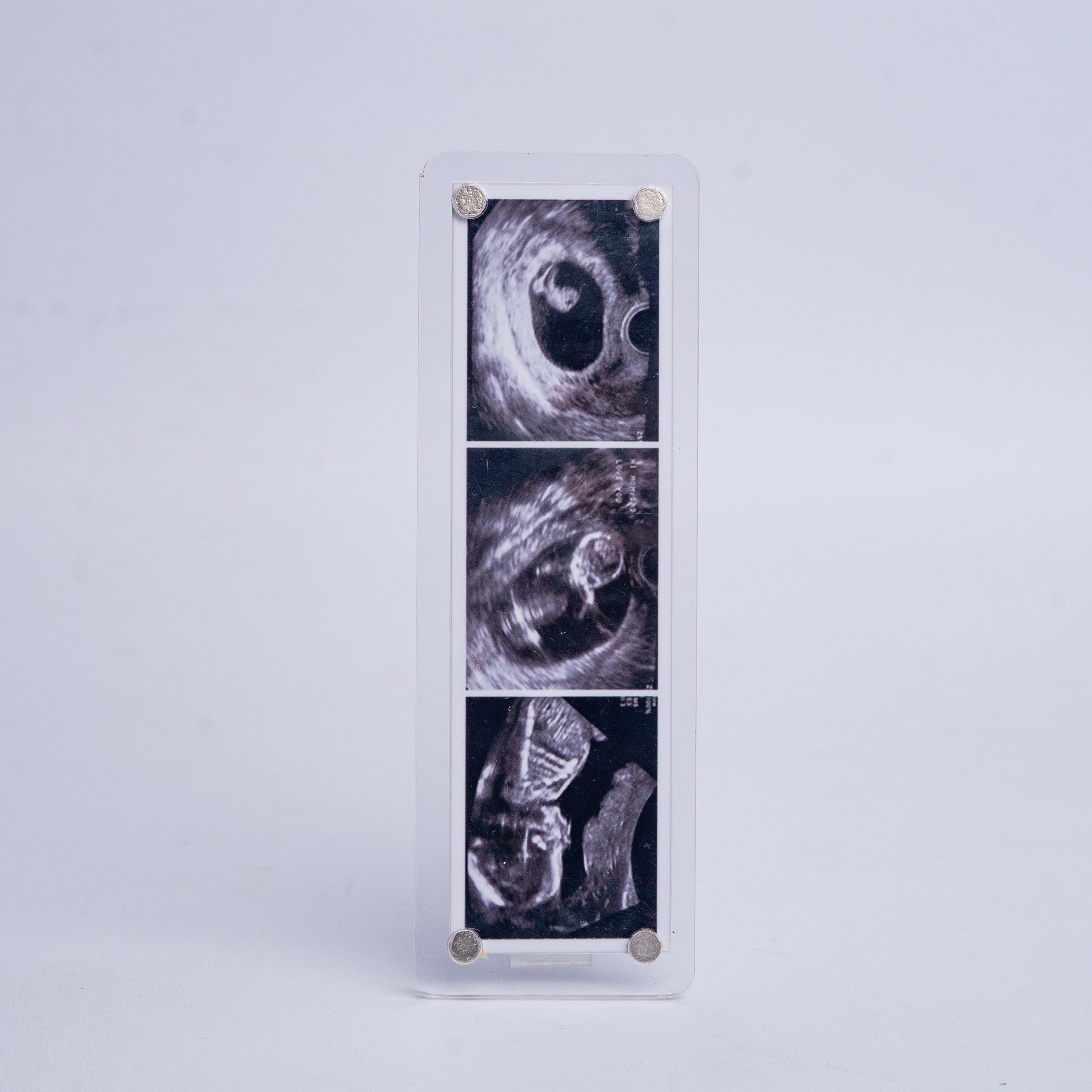Sonogram Magnets Sonogram fridge magnet – Leegifts